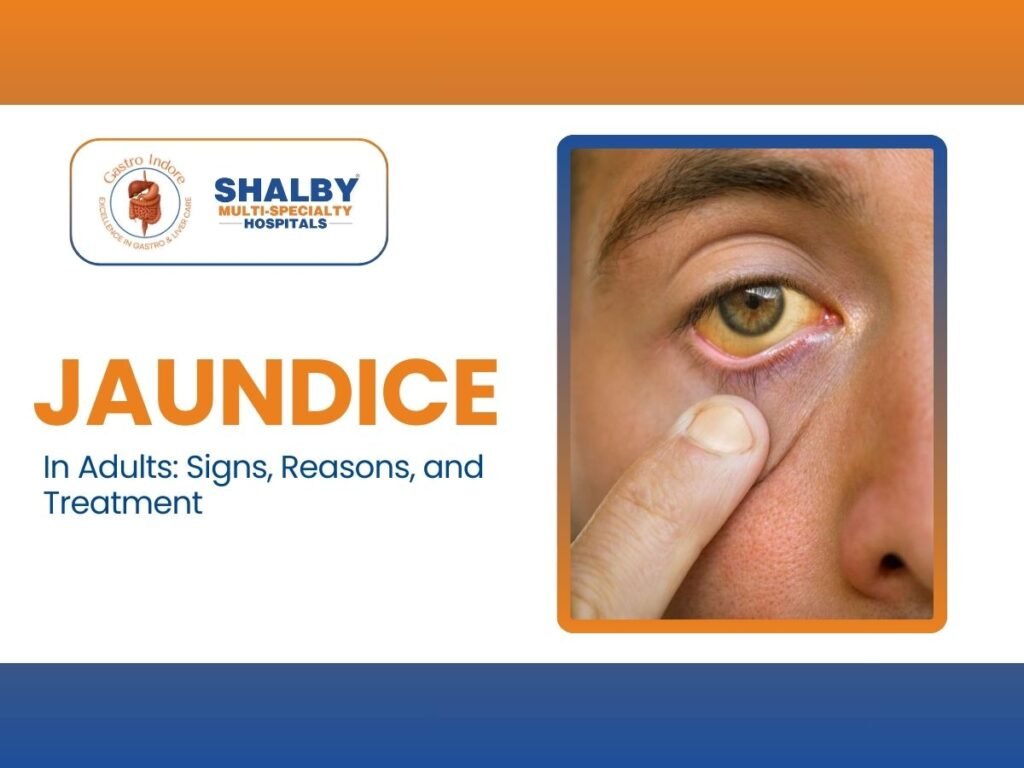 Adult jaundice symptoms like yellow skin and eyes, liver disorder signs, causes and treatment options explained