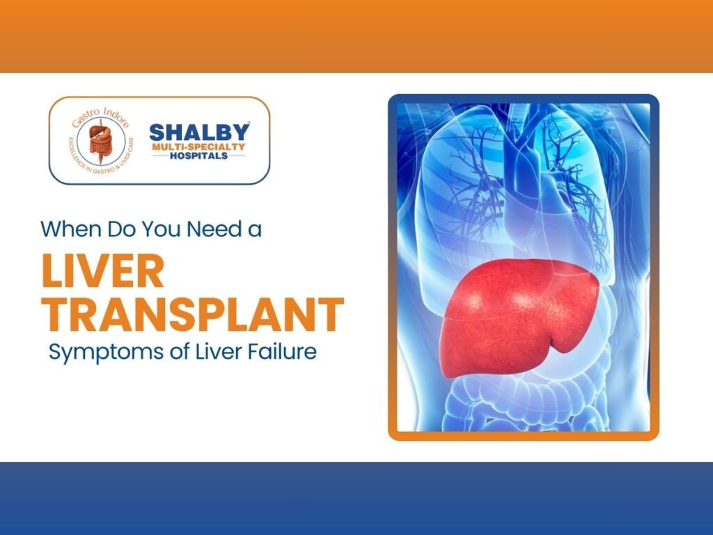 Liver failure symptoms, signs you need a liver transplant, advanced liver disease warning signs and treatment