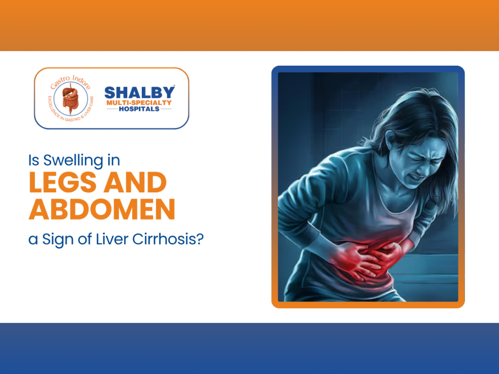 This image explains how swelling in the legs and abdomen can be an early warning sign of liver cirrhosis, ascites, and fluid buildup. Patients in Indore experiencing these symptoms should consult a gastroenterologist or liver specialist for timely diagnosis and treatment.