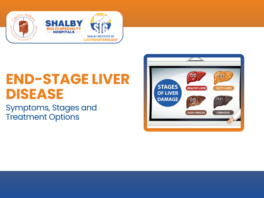 Illustration showing stages and symptoms of end-stage liver disease with medical icons, highlighting treatment options available in Indore for liver failure, cirrhosis, jaundice, swelling, and advanced liver care.