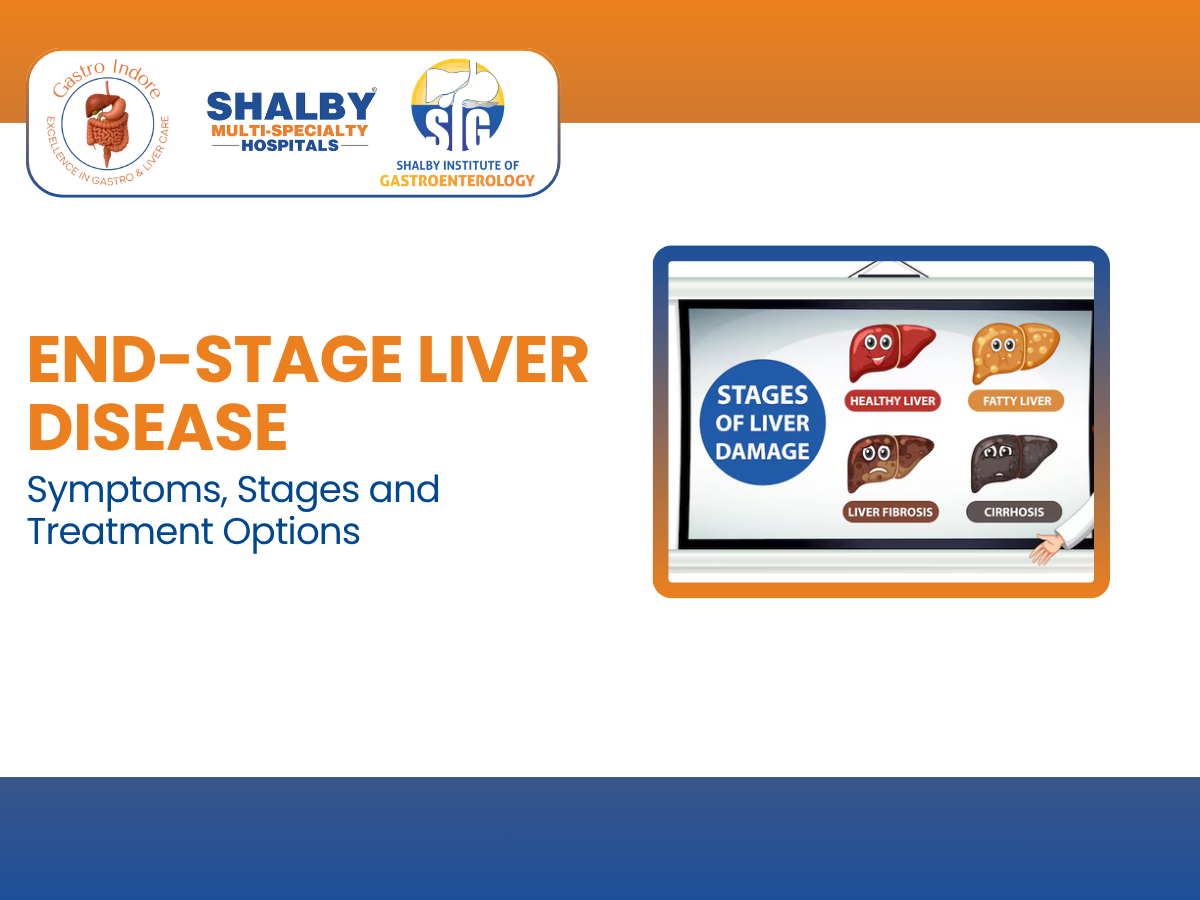 Illustration showing stages and symptoms of end-stage liver disease with medical icons, highlighting treatment options available in Indore for liver failure, cirrhosis, jaundice, swelling, and advanced liver care.